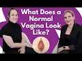 What Does a Normal Vagina Look Like OBGYNs Explain Vaginal Health Anatomy