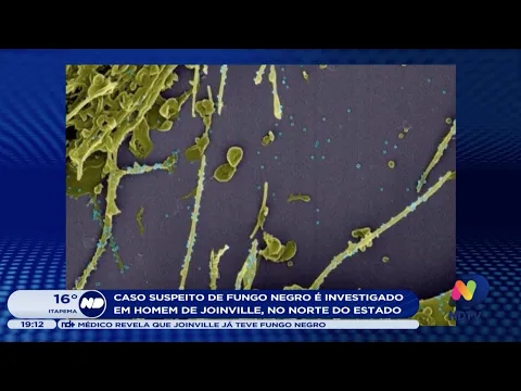 Caso suspeito de fungo negro é investigado em homem de Joinville