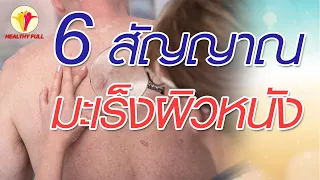  มะเร็งผิวหนังในระยะเริ่มต้นสามารถสังเกตได้จากสัญญาณใดบ้าง 