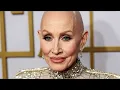 Dolly Parton Reveals Why She Wears Wigs Now She is Out in the Open