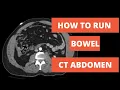 How to read a CT - Approach to Running Bowel