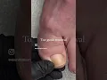 Download Lagu Toe gunk removal *satisfying* #deadskin #pedicure #satisfyingvideo #toenails #cleannails