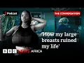 Gigantomastia living with oversized breasts The Conversation Focus on Africa
