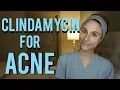 Clindamycin gel for acne Q A with a dermatologist Dr Dray
