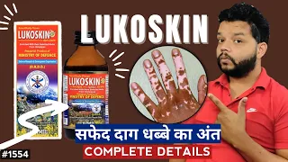 Download सफेद दाग धब्बे हटाने की दवा | Aimil Lukoskin Syrup Review | Medicine For Vitilgo And Leucoderma MP3