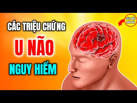 Download MP3 Các Triệu Chứng U Não Bạn Có Thể Mắc Phải - Sức Khỏe Tràn Đầy