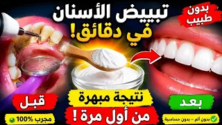 ملعقة نشا‼️اقسم بالله لن تحتاج للذهاب لطبيب الأسنان   مرة اخري‼️تبييض الاسنان فى ثوانى