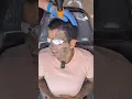 Download Lagu Oh my God, his face is exploded !!!😱😱😱#shorts #laser #remove #tattoo #photon #scar #face #hollywood