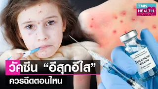  ใครมีความเสี่ยงต่อภาวะแทรกซ้อนจากโรคอิสุอิสัยบ้าง 