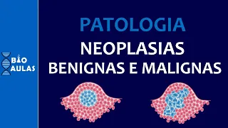 Benign and Malignant Neoplasms - Characteristics, Nomenclature and Differentiation (General Patho...