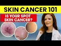 SKIN CANCER Basal Cell Carcinoma and What You NEED to Know Explained by a Dermatologist