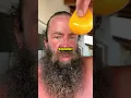 The Liver King Arrested Again
