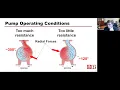 Pump 101 - Basics Pump Operation Selection and Troubleshooting