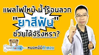  ทำไมไม่ควรเอายาสีฟันมาทาแผลไฟไหม้หรือลวกด้วยน้ำร้อน 