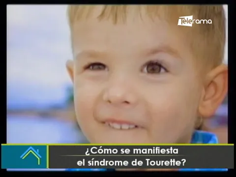 ¿Cómo se manifiesta el síndrome de Tourette?
