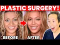 BEYONCE Plastic Surgery Transformation - Cosmetic Surgeon Reacts