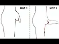 Download Lagu The One Exercise That's Changing Everything! Do These Exercises Every Day!