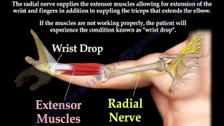 radial nerve palsy injury wrist drop everything you need to know dr nabil ebraheim