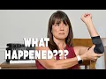 Olecranon Bursitis and my Post Rotator Cuff Surgery Week 8 Update