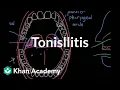 Tonsillitis Respiratory system diseases NCLEX-RN Khan Academy