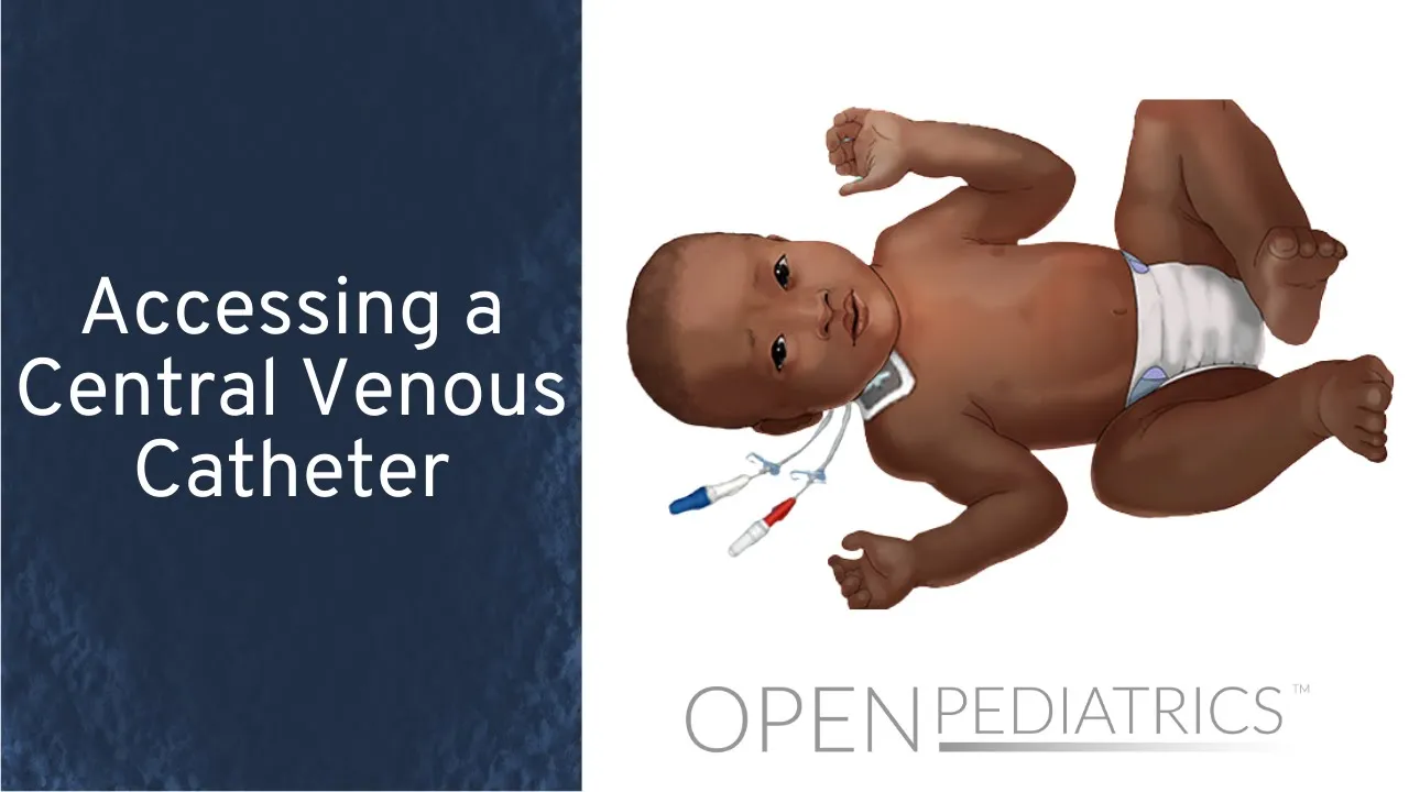 Accessing a Central Venous Catheter by M. Manning | OPENPediatrics