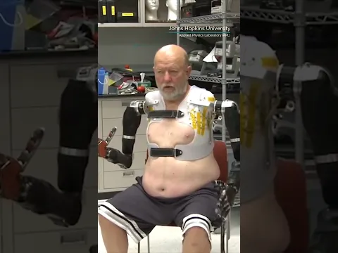 Mind controlled prosthesis