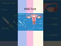 Download Lagu #hsgtest kya hai ? #pregnancy #health #amazing #viral #youtubeshorts