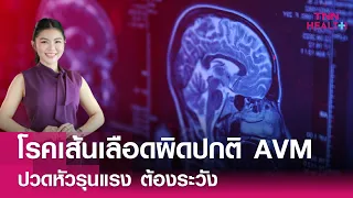 โรคเส้นเลือดผิดปกติในสมองคืออะไร