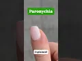 Paronychia explained Learn how to deal with an infected nail