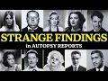 WEIRD Things Found In Celebrity Autopsy Reports Golden Era Edition