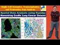 Spatial Data Analysis using Squidpy Nanostring CosMx Lung Cancer Dataset