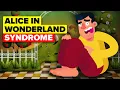 This Syndrome Will Make You Question What Is Real Alice In Wonderland Syndrome