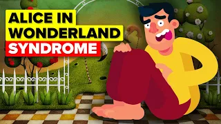 This Syndrome Will Make You Question What Is Real Alice In Wonderland Syndrome