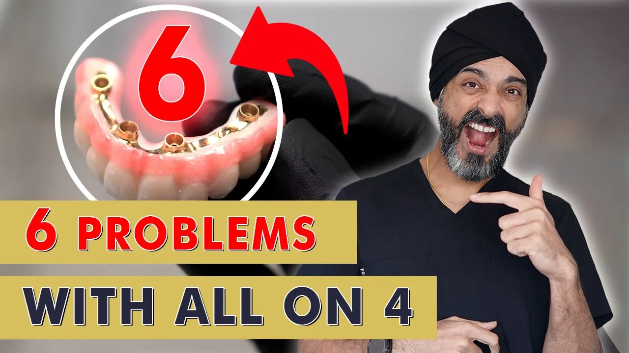 Outline Video 6 Things your Dentist May NOT tell you about All on 4 or a Full Set of Dental Implants