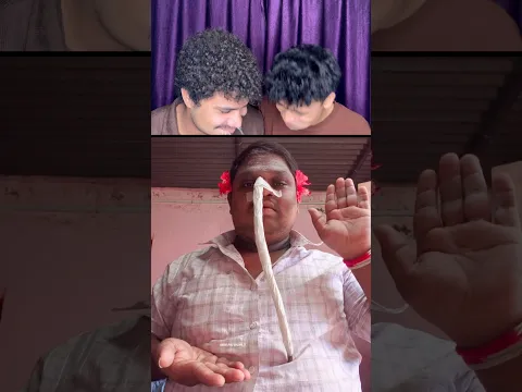 TRY NOT TO LAUGH 😂||WAIT FOR END||MRB PART-1332