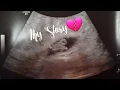 My Missed Miscarriage Story Slow rising HCG Low progesterone
