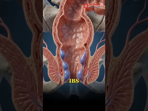 सुबह पेट साफ नहीं होता? कब्ज के ये कारण जरूर जानें | Constipation से राहत कैसे पाएं?