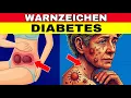 Download Lagu 14 Warnzeichen für zu hohen Blutzucker (Diabetes-Alarm!)