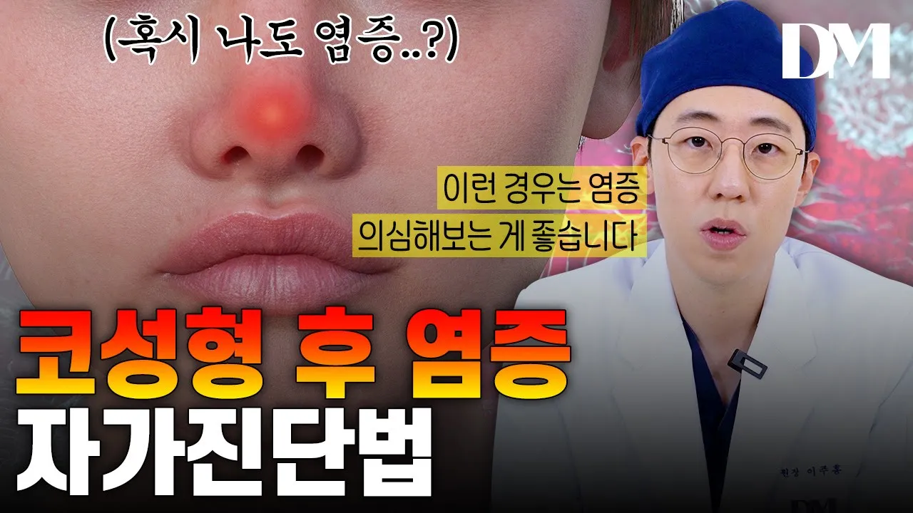 성형 한 후 내 코, 염증에 괜찮을까? 염증 자가진단 하는법!😊 #코성형 #코성형부작용 #코염증