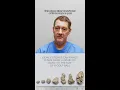 Can you Pass a Kidney Stone on Your Own