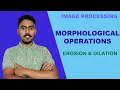 Morphological Operations Erosion and Dilation - Solved Example Image Processing