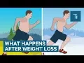 What Losing Weight Does To Your Body And Brain The Human Body