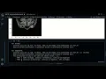 1 1 - MRI image orientation with SimpleITK