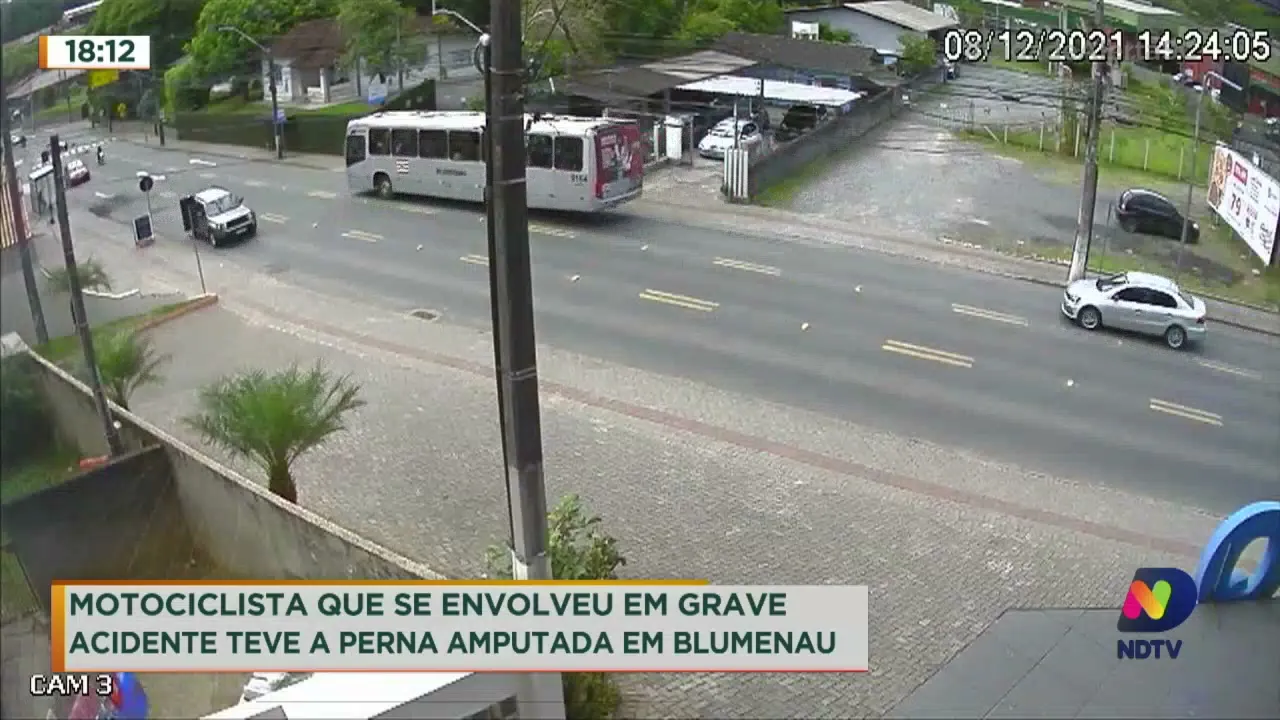 Motociclista acidentado teve perna amputada em Blumenau