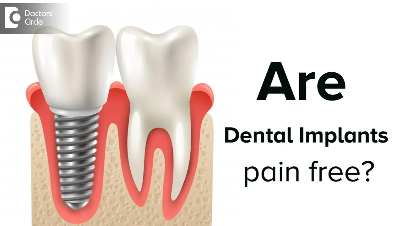 Outline Video Are dental implant procedures painful? - Dr. Vahini Reddy | Doctors' Circle