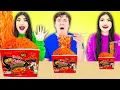 Download Lagu GIANT VS TINY FOOD CHALLENGE | BIG VS MEDIUM VS SMALL PLATE CHALLENGE BY SWEEDEE