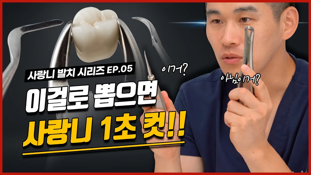 사랑니 발치! 이 도구로 결정 납니다 | 사랑니 발치 도구,  사랑니 발치
