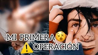 me oper la nariz parte 1 axel ortiz moran