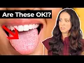 what do BUMPS on your TONGUE mean