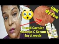 I Used NEW Garnier Vitamin C Serum For A Week See Result|GARNIER VITAMIN C SERUM REVIEW|Shinny Roops